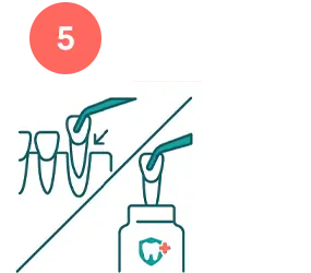 An illustration showing tweezers reinserting a knocked-out tooth or placing it in preservation fluid.