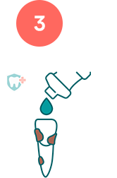 Diagram showing liquid being poured to gently rinse a dirty knocked out tooth.