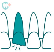 knocked out tooth kit