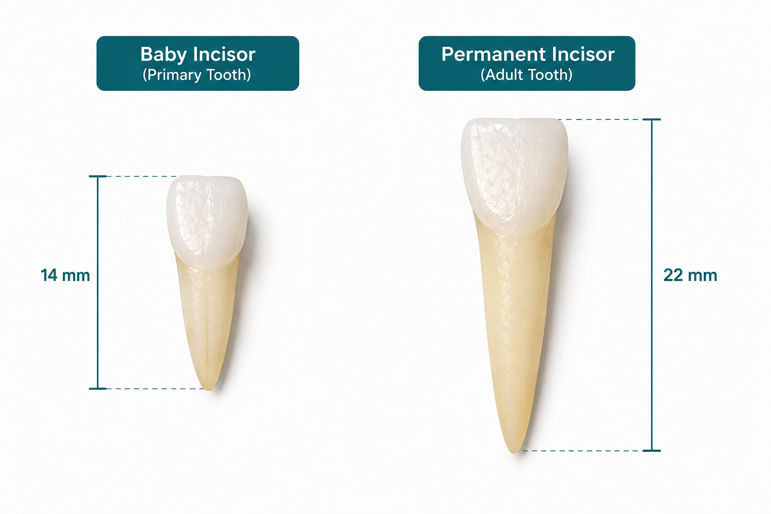Baby incisor and permanent incisor shown side by side, actual-size comparison