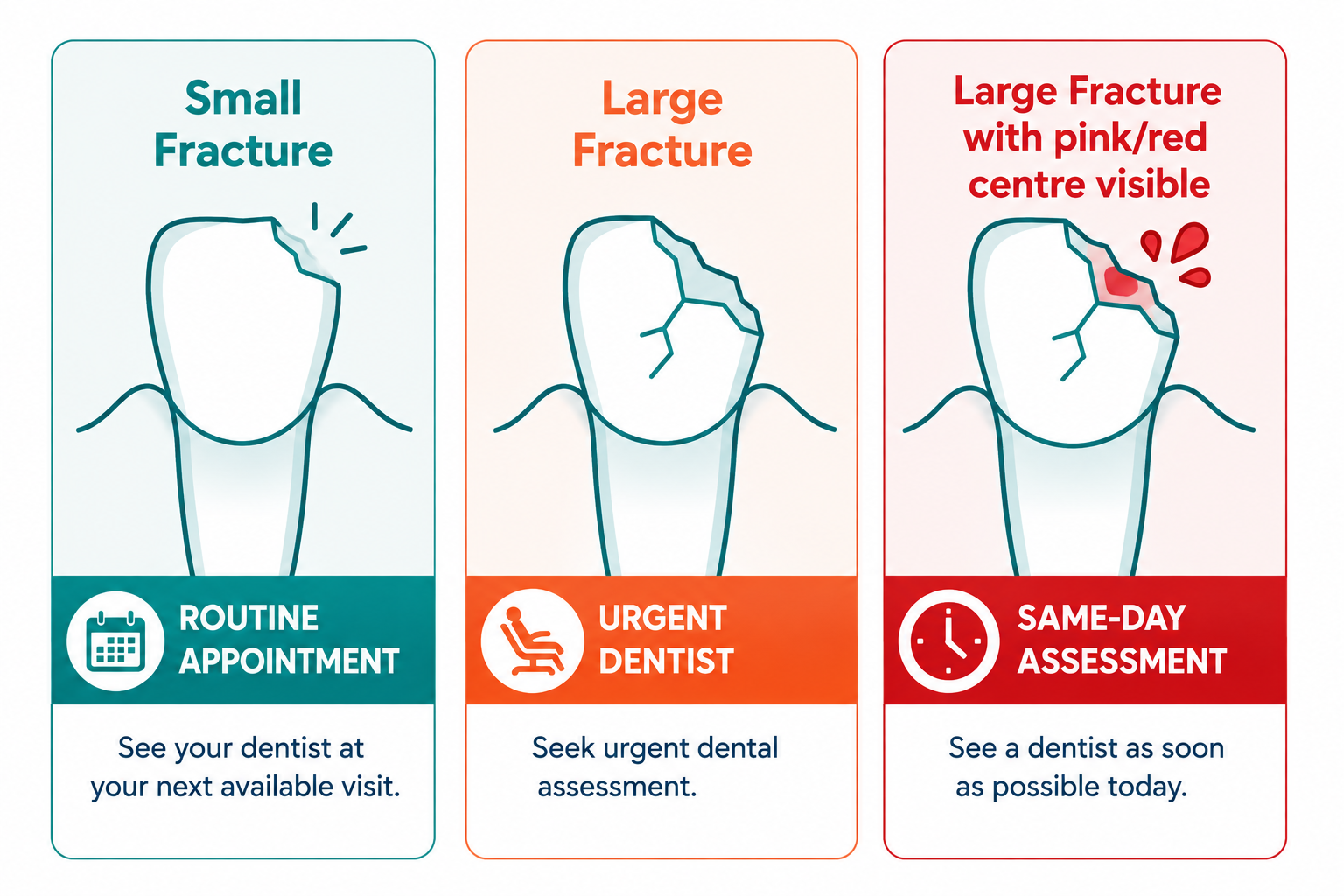 Simple three-tier classification: small chip - routine appointment; large fracture - urgent dentist; pink or red centre visible - same-day assessment